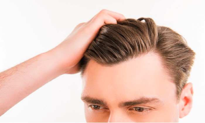 HAIR MESOTHERAPY HAIR MESOTHERAPY
